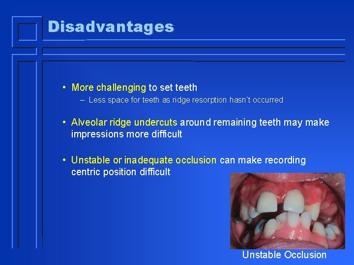 Disadvantages • More challenging to set teeth – Less space for teeth as ridge