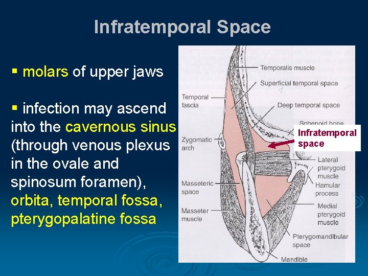 Infratemporal Space § molars of upper jaws § infection may ascend into the cavernous