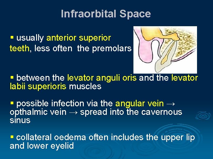 Infraorbital Space § usually anterior superior teeth, less often the premolars § between the