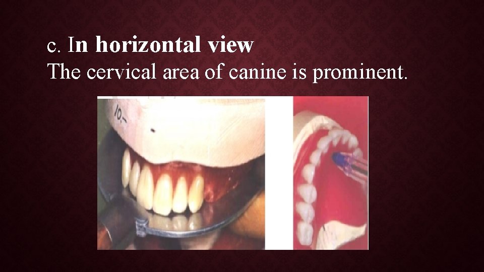 c. In horizontal view The cervical area of canine is prominent. 