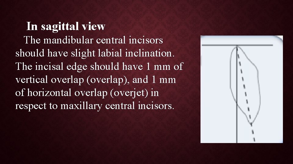 In sagittal view The mandibular central incisors should have slight labial inclination. The incisal