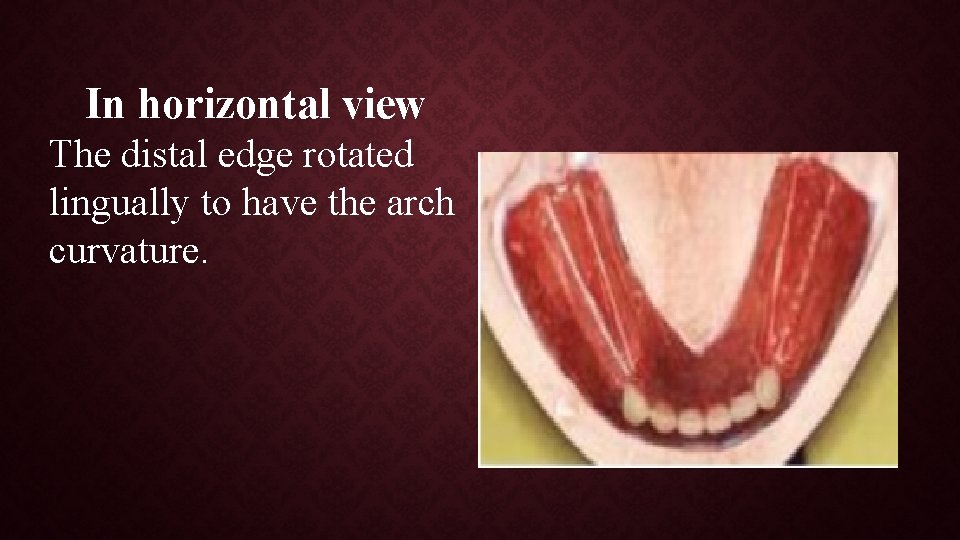 In horizontal view The distal edge rotated lingually to have the arch curvature. 