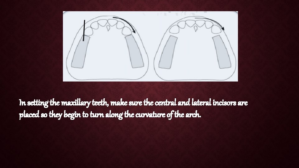 In setting the maxillary teeth, make sure the central and lateral incisors are placed