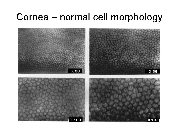 Cornea – normal cell morphology Cornea – normal cell morphology