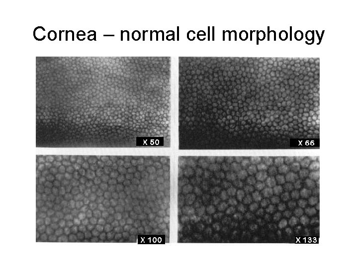 Cornea – normal cell morphology 