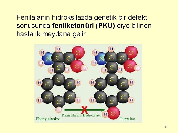 Fenilalanin hidroksilazda genetik bir defekt sonucunda fenilketonüri (PKU) diye bilinen hastalık meydana gelir 30