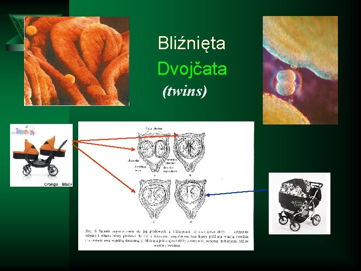 Bliźnięta Dvojčata (twins) 