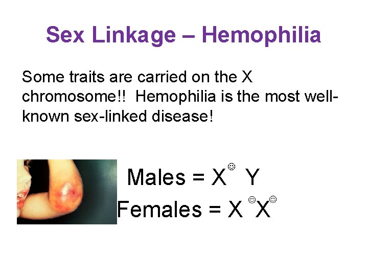 Sex Linkage – Hemophilia Some traits are carried on the X chromosome!! Hemophilia is