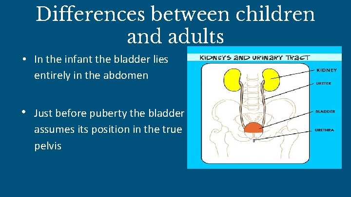 Differences between children and adults • In the infant the bladder lies entirely in