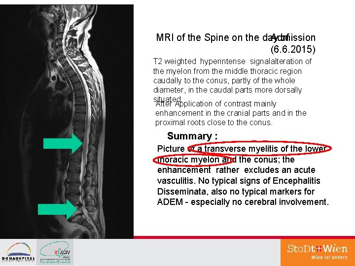 MRI of the Spine on the day of Admission (6. 6. 2015) T 2