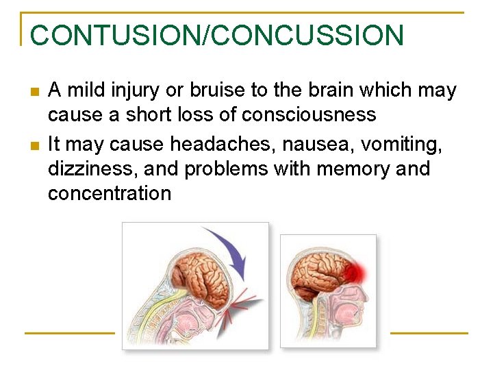 CONTUSION/CONCUSSION n n A mild injury or bruise to the brain which may cause