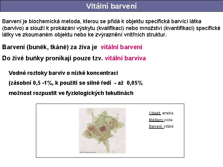 Vitální barvení Barvení je biochemická metoda, kterou se přidá k objektu specifická barvící látka Vitální barvení Barvení je biochemická metoda, kterou se přidá k objektu specifická barvící látka
