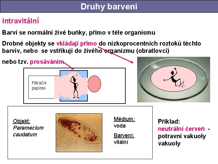 Druhy barvení Intravitální Barví se normální živé buňky, přímo v těle organismu Drobné objekty Druhy barvení Intravitální Barví se normální živé buňky, přímo v těle organismu Drobné objekty