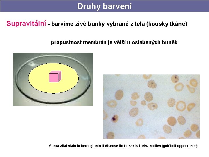 Druhy barvení Supravitální - barvíme živé buňky vybrané z těla (kousky tkáně) propustnost membrán Druhy barvení Supravitální - barvíme živé buňky vybrané z těla (kousky tkáně) propustnost membrán