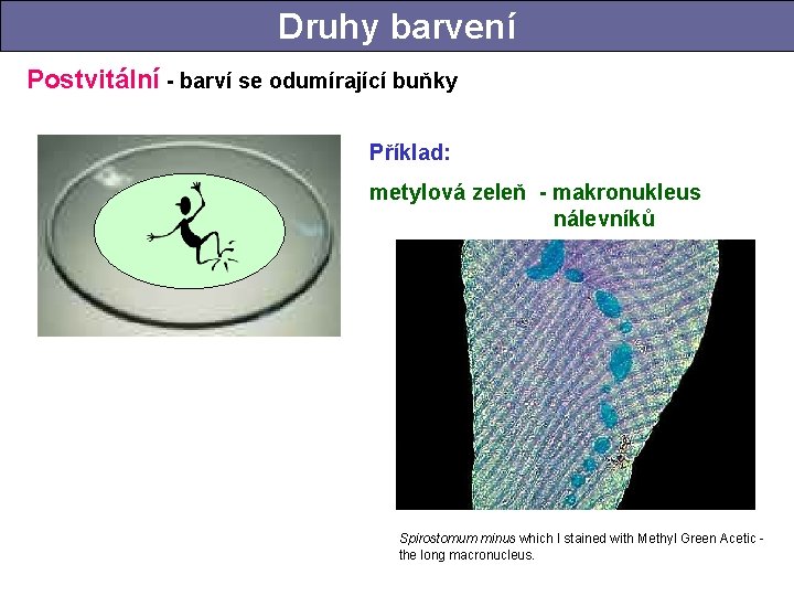 Druhy barvení Postvitální - barví se odumírající buňky Příklad: metylová zeleň - makronukleus nálevníků Druhy barvení Postvitální - barví se odumírající buňky Příklad: metylová zeleň - makronukleus nálevníků