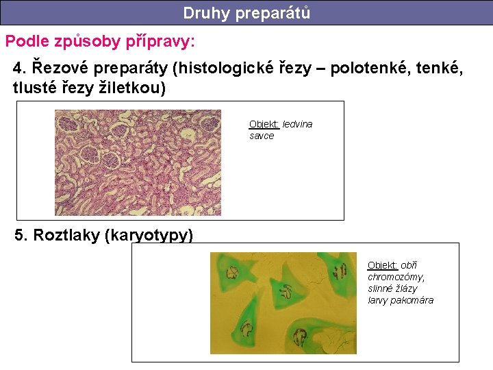 Druhy preparátů Podle způsoby přípravy: 4. Řezové preparáty (histologické řezy – polotenké, tlusté řezy Druhy preparátů Podle způsoby přípravy: 4. Řezové preparáty (histologické řezy – polotenké, tlusté řezy