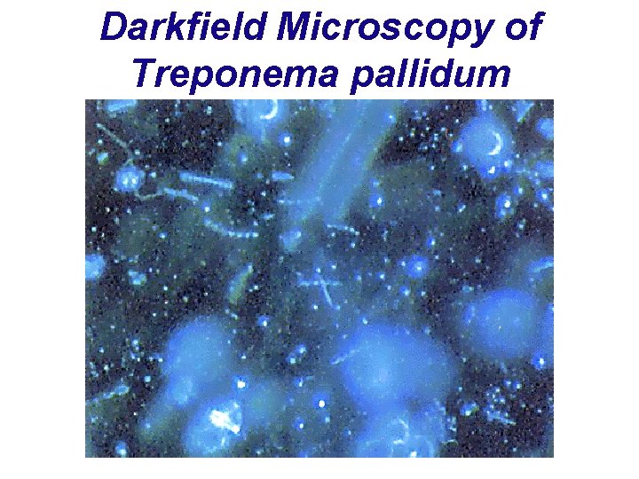 Darkfield Microscopy of Treponema pallidum 