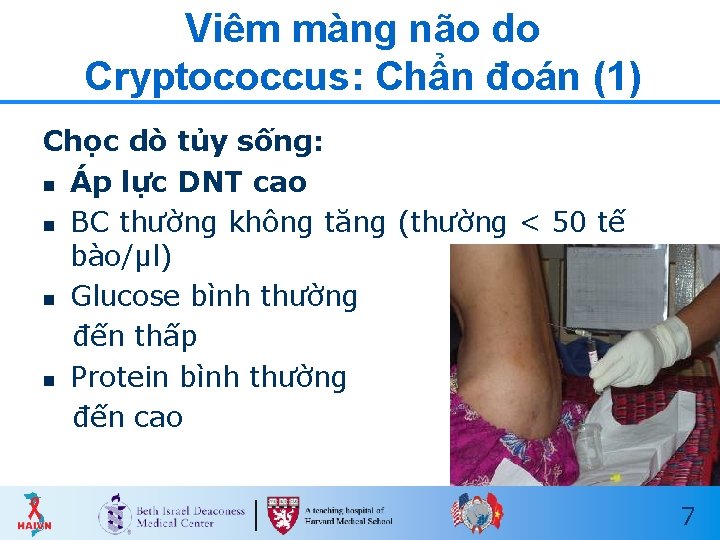 Viêm màng não do Cryptococcus: Chẩn đoán (1) Chọc dò tủy sống: n Áp