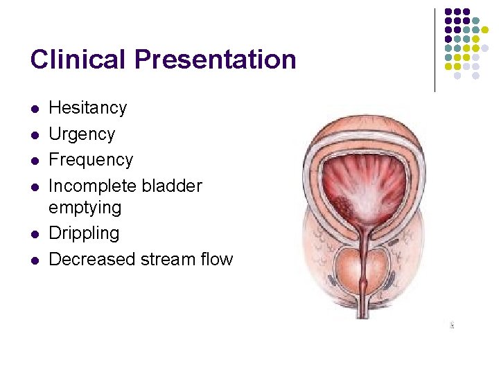 Clinical Presentation l l l Hesitancy Urgency Frequency Incomplete bladder emptying Drippling Decreased stream