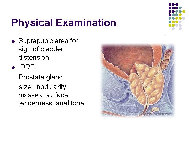 Physical Examination l l Suprapubic area for sign of bladder distension DRE: Prostate gland