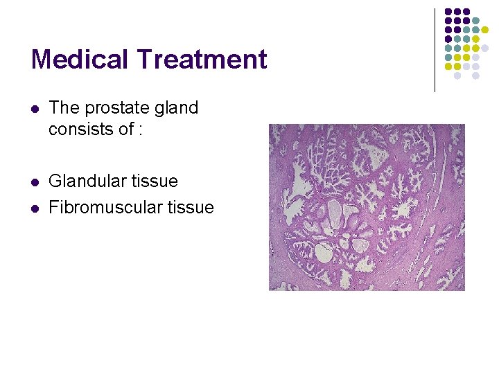 Medical Treatment l The prostate gland consists of : l Glandular tissue Fibromuscular tissue