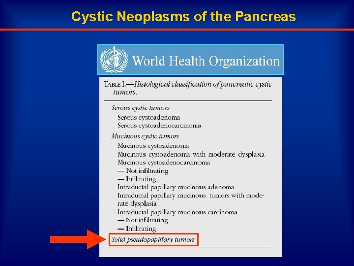 Cystic Neoplasms of the Pancreas 