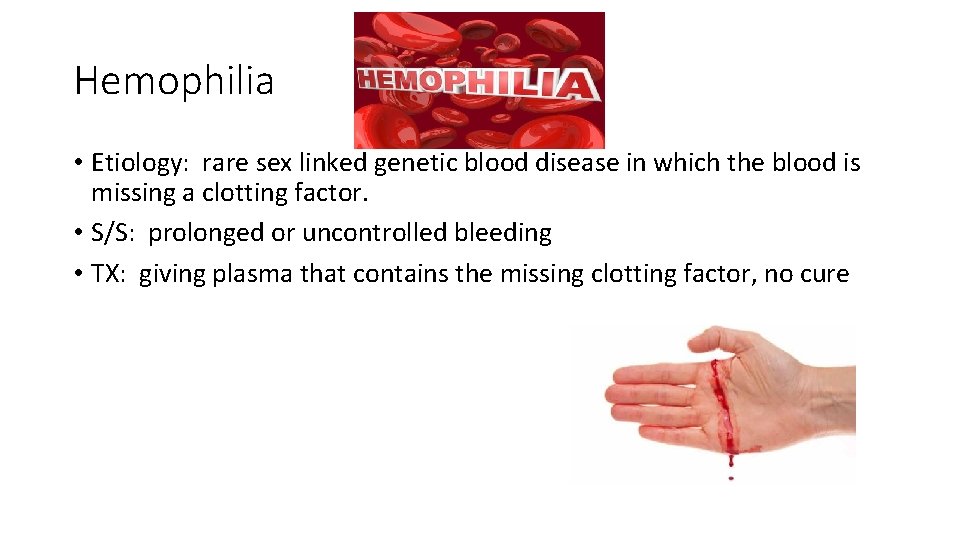 Hemophilia • Etiology: rare sex linked genetic blood disease in which the blood is