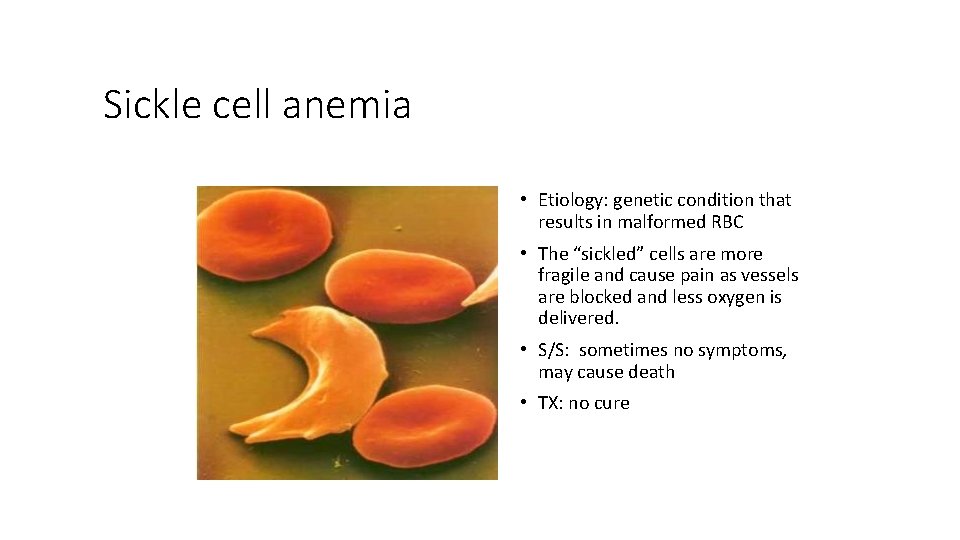 Sickle cell anemia • Etiology: genetic condition that results in malformed RBC • The
