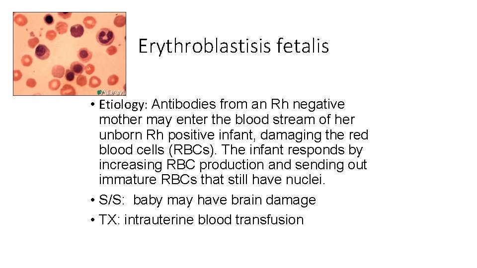 Erythroblastisis fetalis • Etiology: Antibodies from an Rh negative mother may enter the blood