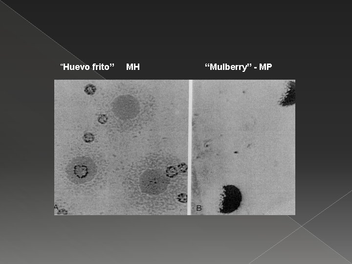 “Huevo frito” MH “Mulberry” - MP 