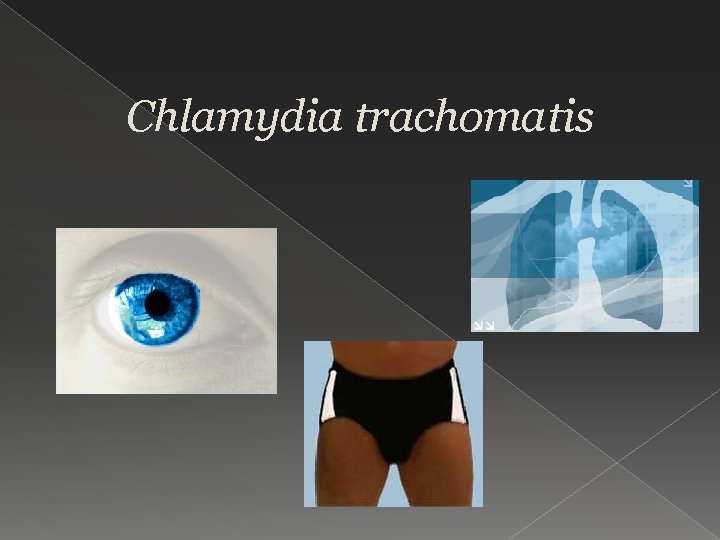 Chlamydia trachomatis 