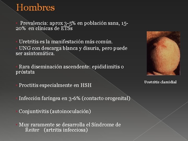 Hombres • Prevalencia: aprox 3 -5% en población sana, 1520% en clínicas de ETSs