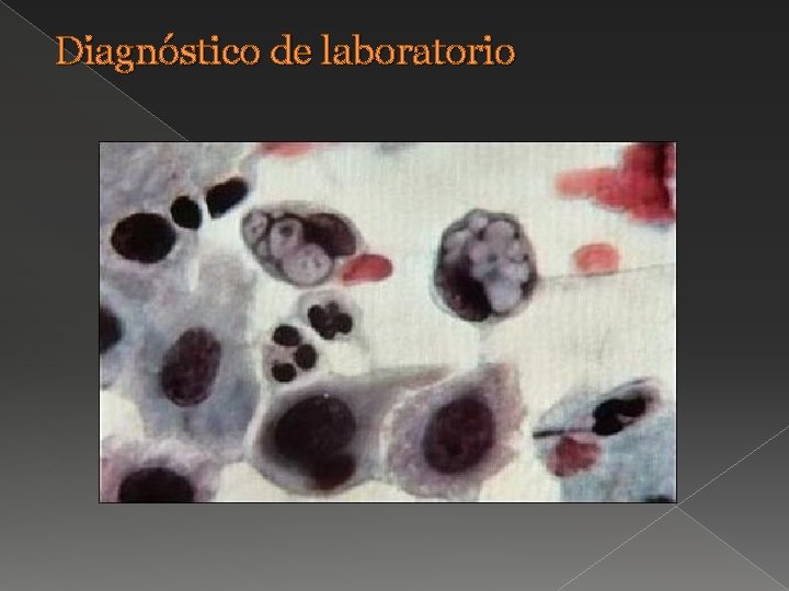 Diagnóstico de laboratorio 