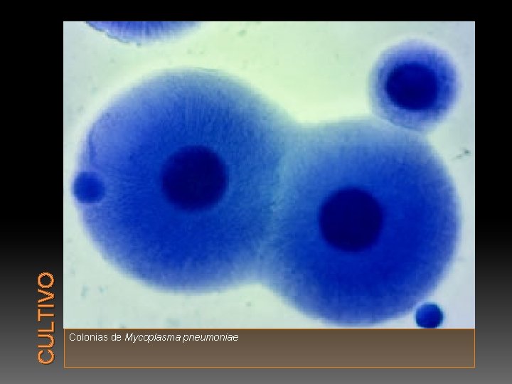 CULTIVO Colonias de Mycoplasma pneumoniae 