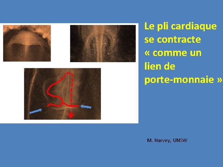 Le pli cardiaque se contracte « comme un lien de porte-monnaie » M. Harvey,