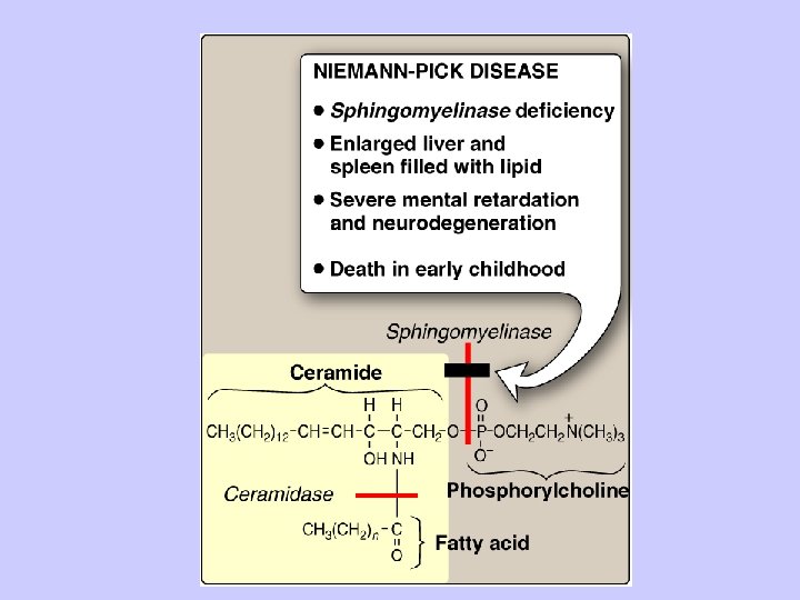 Niemann - Pick Disease 