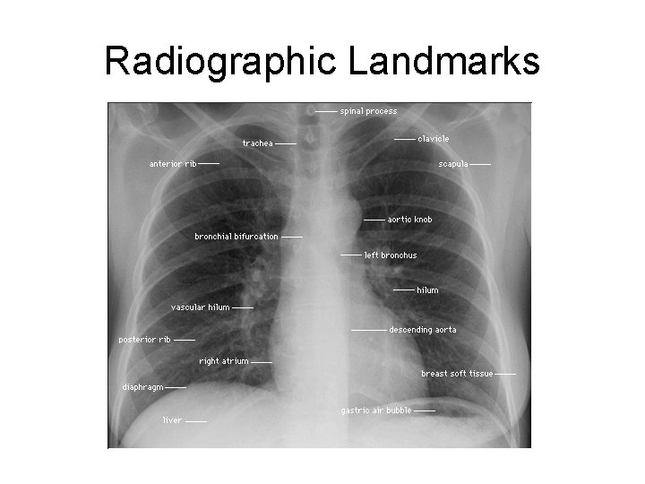 Radiographic Landmarks Radiographic Landmarks