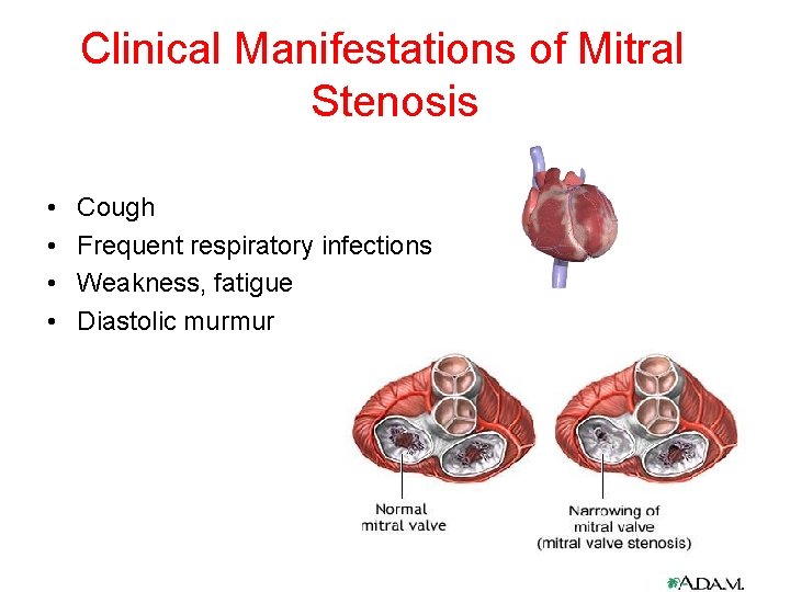 Clinical Manifestations of Mitral Stenosis • • Cough Frequent respiratory infections Weakness, fatigue Diastolic Clinical Manifestations of Mitral Stenosis • • Cough Frequent respiratory infections Weakness, fatigue Diastolic