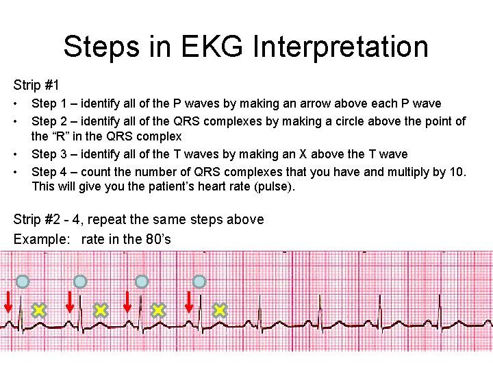 Steps in EKG Interpretation Strip #1 • • Step 1 – identify all of