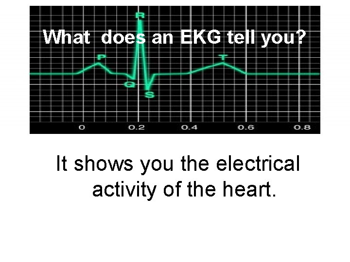 What does an EKG tell you? It shows you the electrical activity of the