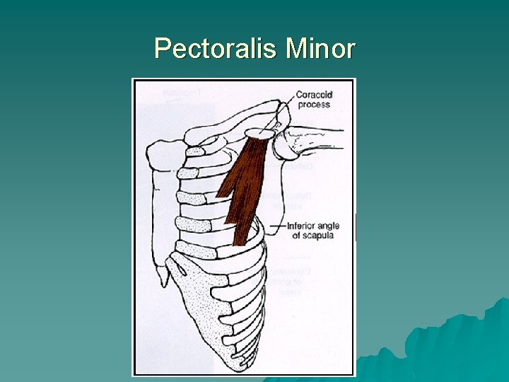 Pectoralis Minor 