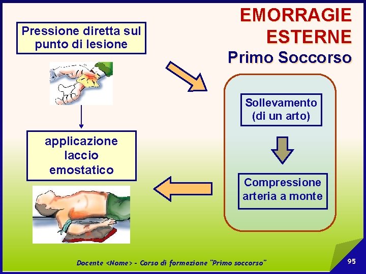 Pressione diretta sul punto di lesione EMORRAGIE ESTERNE Primo Soccorso Sollevamento (di un arto)