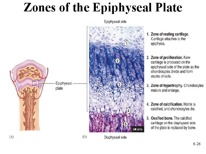 Zones of the Epiphyseal Plate 6 -26 