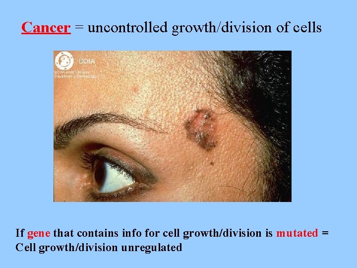 Cancer = uncontrolled growth/division of cells If gene that contains info for cell growth/division