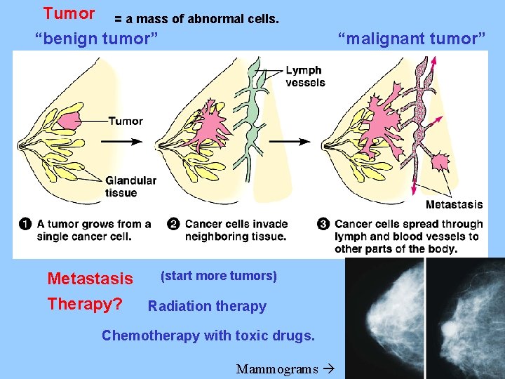 Tumor = a mass of abnormal cells. “benign tumor” (start more tumors) Metastasis Therapy?
