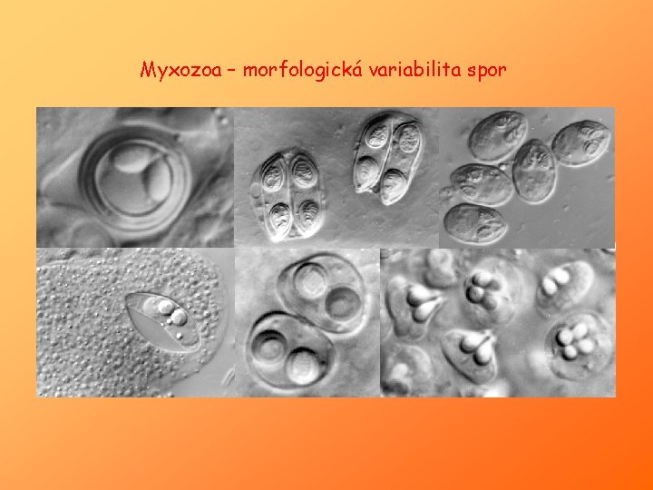 Myxozoa – morfologická variabilita spor 