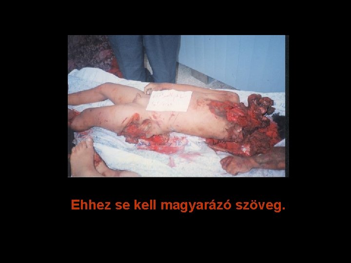 Ehhez se kell magyarázó szöveg. 