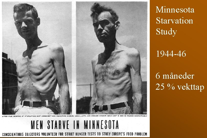 Minnesota Starvation Study 1944 -46 6 måneder 25 % vekttap 