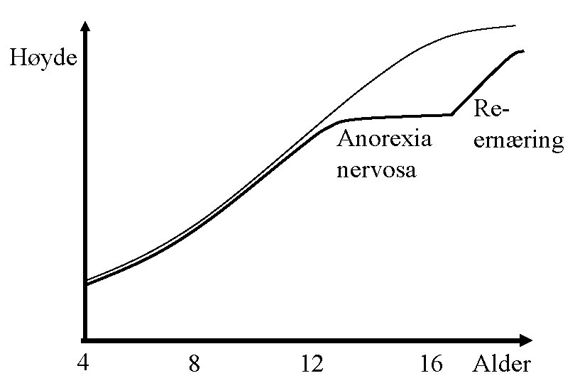 Høyde Anorexia nervosa 4 8 12 Reernæring 16 Alder 