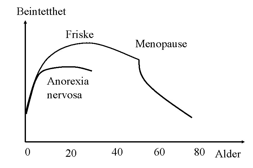 Beintetthet Friske Menopause Anorexia nervosa 0 20 40 60 80 Alder 